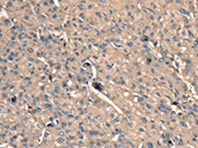 Anti-SCN1B