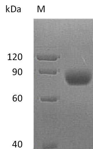 MHC class I polypeptide-related sequence A (MICA), partial (Active), human, recombinant