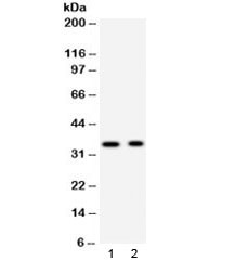 Anti-Synaptophysin