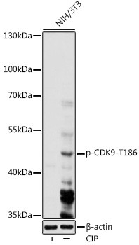 Anti-phospho-CDK9 (Thr186)