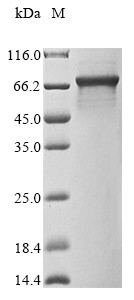 Interleukin-1 receptor-associated kinase 3 (Irak3), mouse, recombinant
