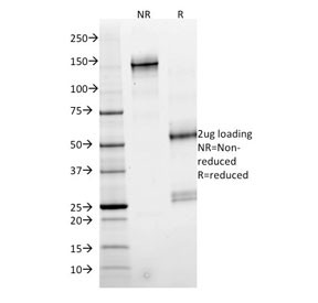 Anti-SMAD4, clone SMAD4/2524