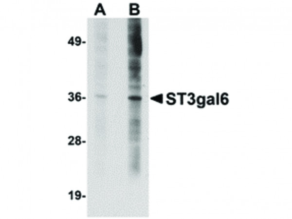 Anti-ST3gal6