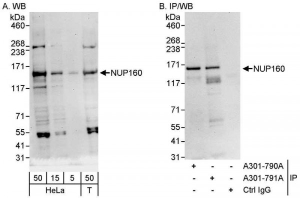 Anti-NUP160