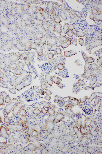 Anti-Serum amyloid P component