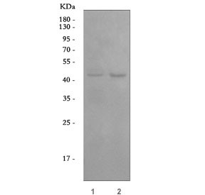 Anti-Angiopoietin-like 4 / ANGPTL4