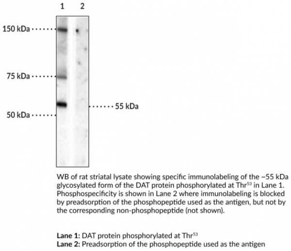 Anti-phospho-Dopamine Transporter (Thr53)