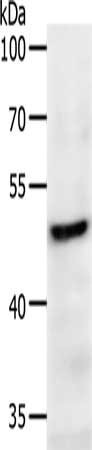 Anti-PDK2