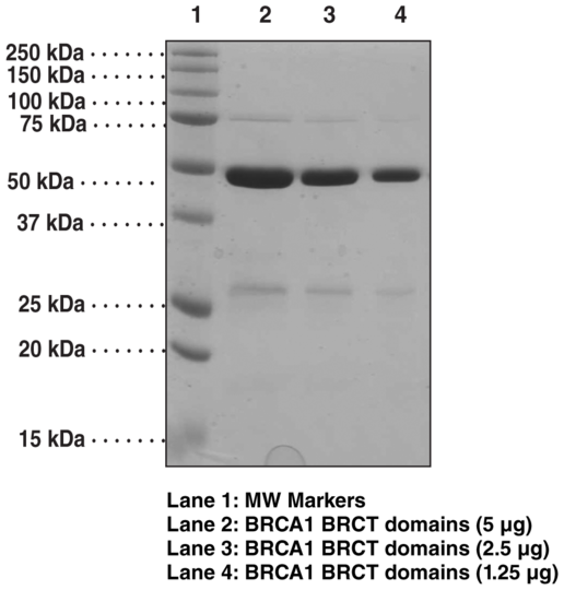 BRCA1 BRCT domains (human, recombinant)