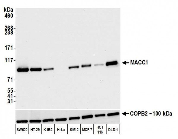 Anti-MACC1 Recombinant Monoclonal