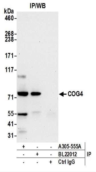 Anti-COG4