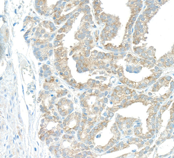 Anti-EBP1