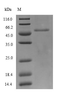 Nucleoprotein (NP), partial, Reston ebolavirus, recombinant