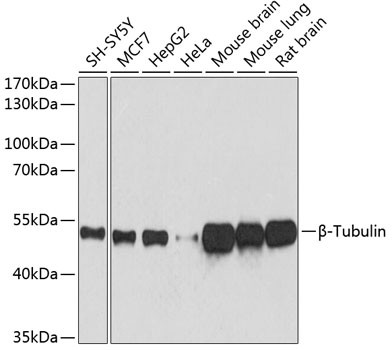 Anti-Beta-Tubulin (CABC021)