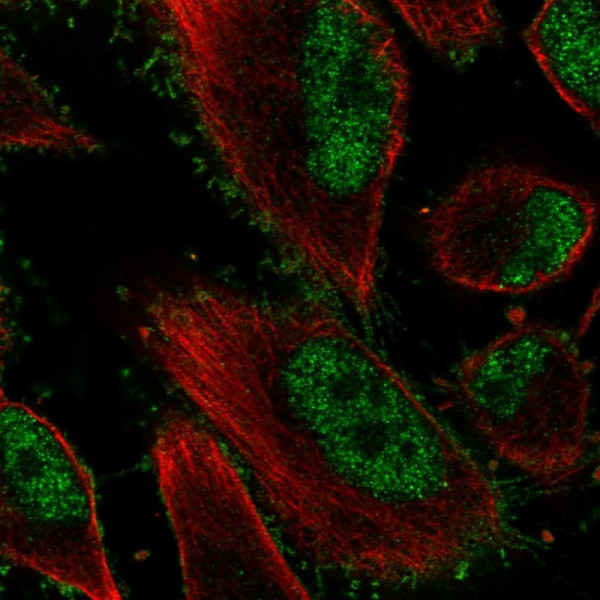 Anti-EPHB2