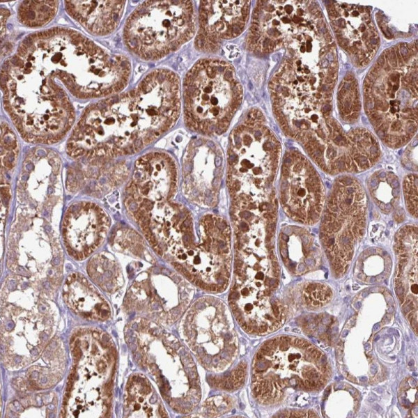 Anti-PNMA6A