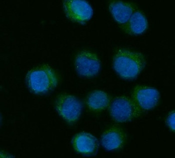 Anti-CYP7A1