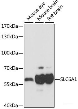 Anti-SLC6A1