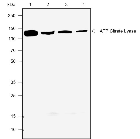 Anti-Recombinant ATP Citrate Lyase, clone A772