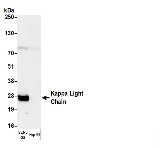 Anti-Human Kappa Light Chain, Biotin conjugated