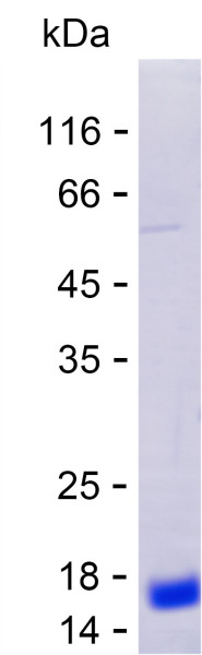 Recombinant Human FERMT2 Protein