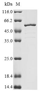 Troponin T, cardiac muscle (Tnnt2), rat, recombinant
