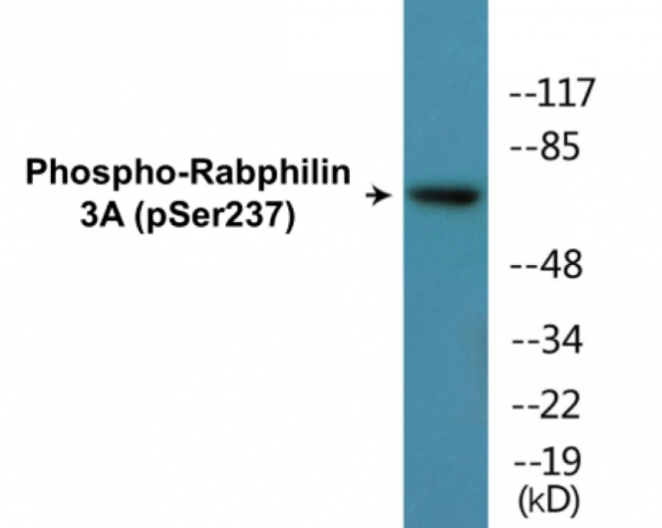 Rabphilin 3A (Phospho-Ser237) Colorimetric Cell-Based ELISA Kit