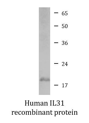 Human IL31 recombinant protein (Active)