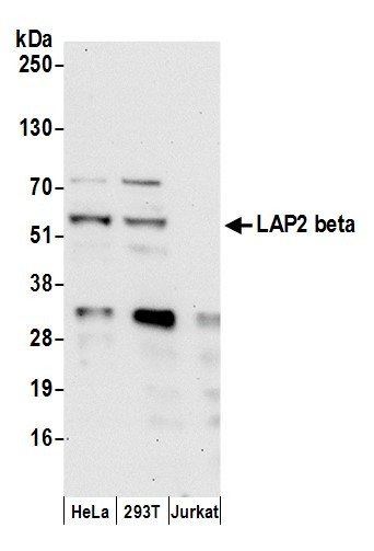 Anti-LAP2 beta gamma/TMPO