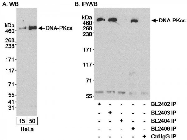 Anti-DNA-PKcs