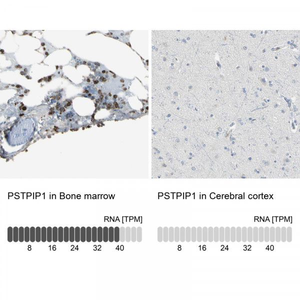 Anti-PSTPIP1