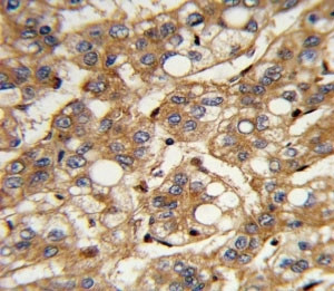 Anti-Interferon beta