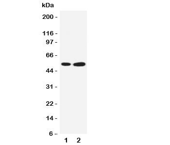 Anti-SBP Selenium Binding Protein