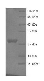 Nidogen-1 (Nid1), partial, mouse, recombinant