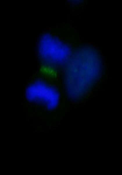 Anti-INCENP (IHC)
