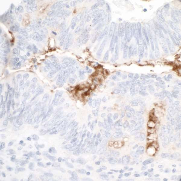 Anti-CD133 Recombinant Monoclonal