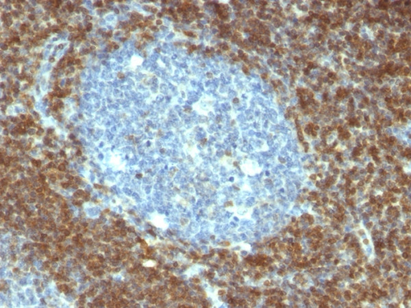 Anti-Bcl-2 (Apoptosis &amp; Follicular Lymphoma Marker), clone BCL2/796