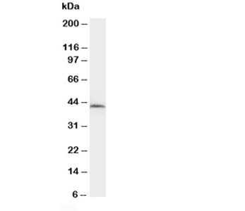 Anti-NPHS2 (Podocin)