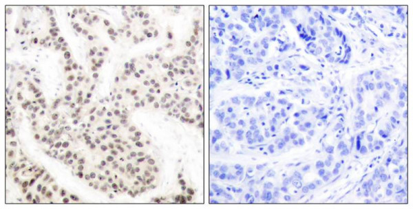 Anti-phospho-Elk1 (Thr417)