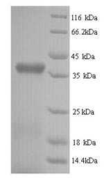 Retinol-binding protein 3 (RBP3), partial, bovine, recombinant