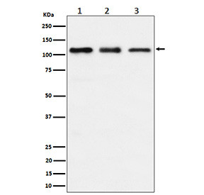 Anti-TAOK1 / Thousand and one amino acid protein kinase 1, clone 30T29