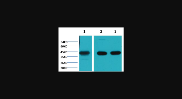 Anti-alpha skeletal muscle actin, monoclonal