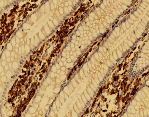 Anti-CD14, clone SQab20193