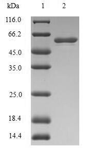 Stromelysin-1 (MMP3), partial, human, recombinant