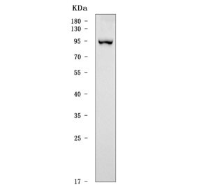 Anti-SATB2 / Special AT-rich sequence-binding protein 2