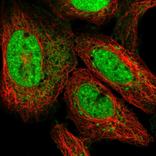 Anti-ATP5S