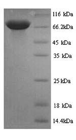 Pyruvate kinase PKLR (Pklr), rat, recombinant