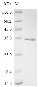 Fibroblast growth factor 2 (FGF2), sheep, recombinant
