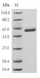 Nucleoside diphosphate kinase, mitochondrial (NME4), human, recombinant
