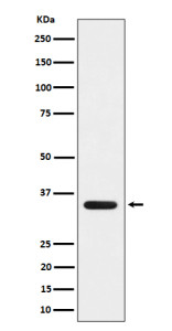 Anti-DEGS1 / DES1 / Dihydroceramide desaturase-1, clone 30D03